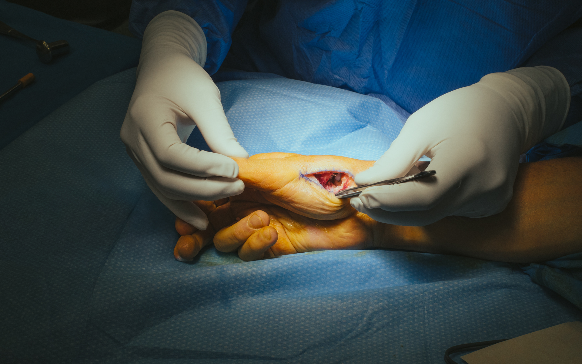 3 months in a surgery room.